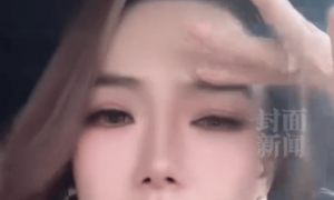 戚薇大方承认医美过度：打僵了，整个眉毛完全动不了